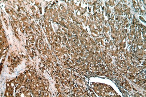 PSAP antibody (18397-1-AP) | Proteintech
