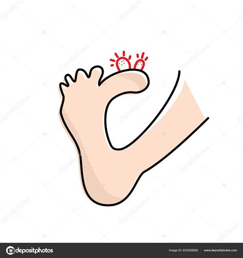 Plantar Wart Icon Verruca Symbol Foot Corn Human Papillomavirus Sign Stock-Vektorgrafik von ...