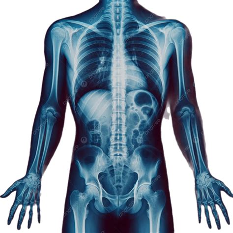 Xray Upper Body