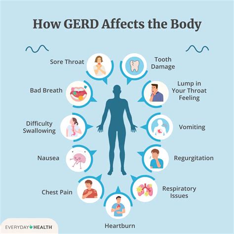 Gastroesophageal Reflux Disease (GERD) Symptoms