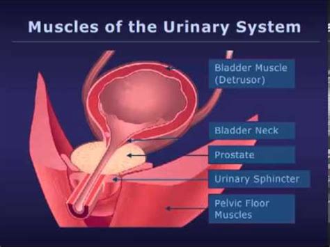 Bladder Botox Injection 的图像结果