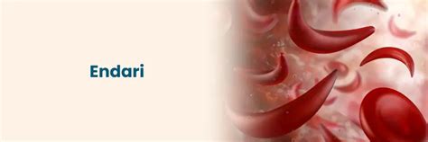 Beneficios de Endari para el tratamiento de la anemia falciforme