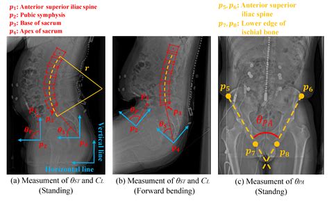 Modeling Joint Stiffness Change by Pelvic Tightening Based on Pelvic ...