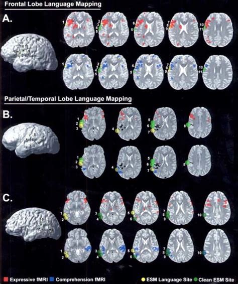 Image result for Language Mapping Scan