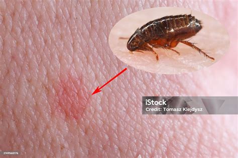 Flea 的图像结果