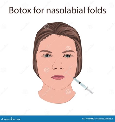 Botox for Nasolabial Folds. Young Woman Face with Syringe. before and after Stock Illustration ...