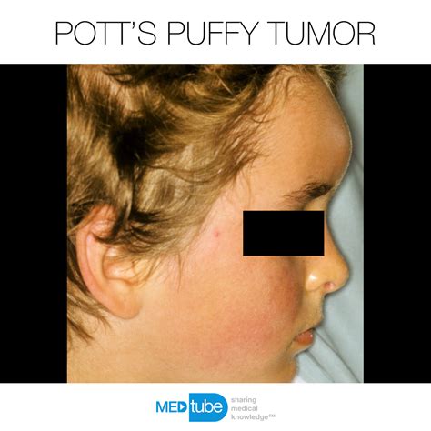 Follow MEDtube on Instagram • MEDtube.net