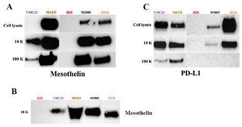Small and Large Extracellular Vesicles Derived from Pleural ...