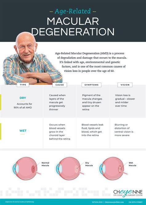 Dry vs. Wet Age-Related Macular Degeneration - Cheyenne Eye Clinic & Surgery Center