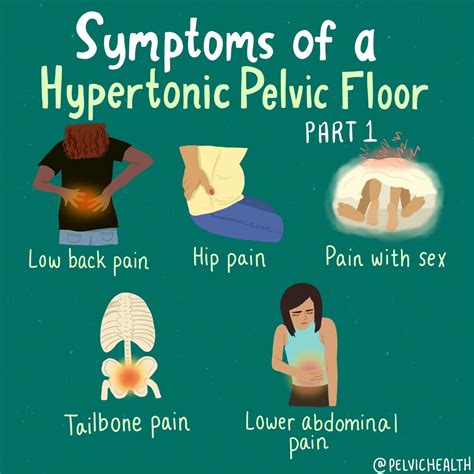 Symptoms Of Pelvic Floor Disease - Infoupdate.org