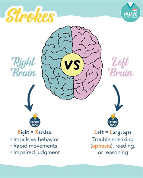 Kristine Tuttle | Right-sided vs. Left-sided Stroke 🧠⚠️ Did you know ...