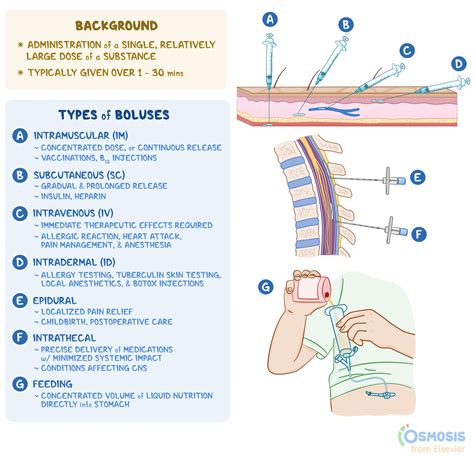 Bolus: What Is It, Different Types, Indications | Osmosis