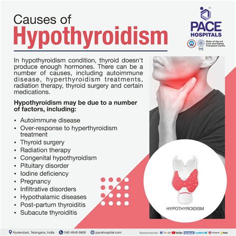 Hypothyroidism – Symptoms, Causes, Complications and Prevention