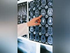 How mutation functions in the brain, affects anxiety and sociality: Study
