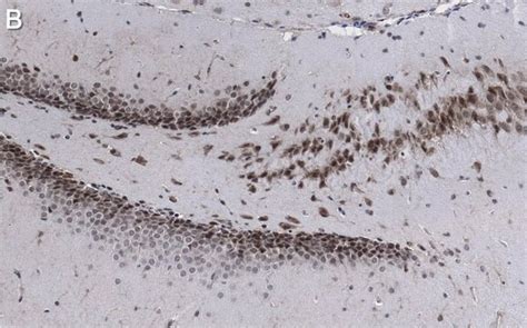 Anti-AFF2 Antibody, clone 1G13 ZooMAb® Rabbit Monoclonal recombinant ...