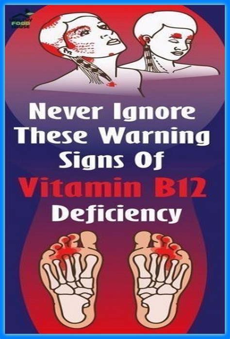 7 Common Signs Of Vitamin B12 Deficiency You Should Never Ignore