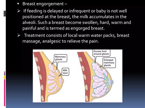 breastfeeding.pptx