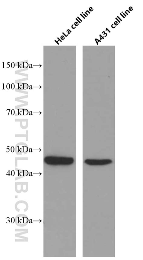 CCRL2 antibody (66611-1-Ig) | Proteintech