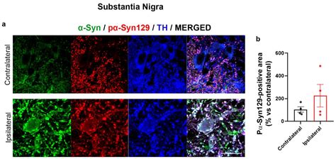 Changes in α-Synuclein Posttranslational Modifications in an AAV-Based ...