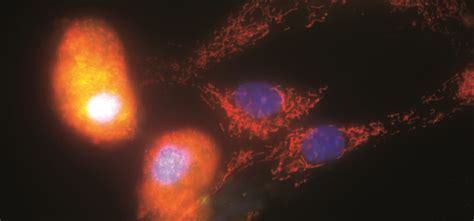 Research | Shapiro Lab at Dana-Farber Cancer Institute