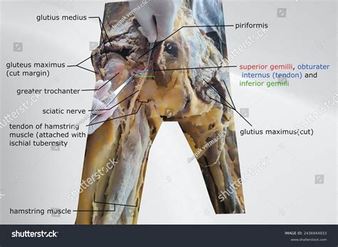 Dissection Gluteal Region Sciatic Nerve Passage Stock Photo 2436944933 | Shutterstock