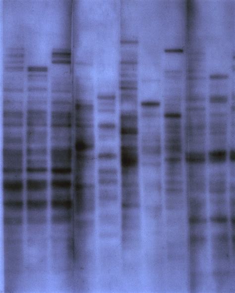 30th Anniversary Of DNA Fingerprinting – Science Museum Blog