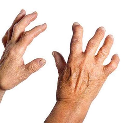 Mace Oil: Buy Mace Essential Oil Online at Best Price in India – VedaOils