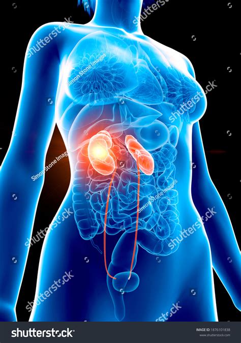 Human Kidney Pain Location