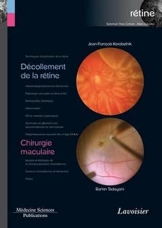 Amazon.in: Buy Decollement de la retine / chirurgie maculaire (volume 6 ...