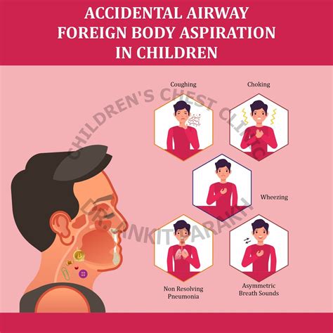 Foreign Body Aspiration in Children: Symptoms, investigations and treatment – Dr. Ankit Parakh ...
