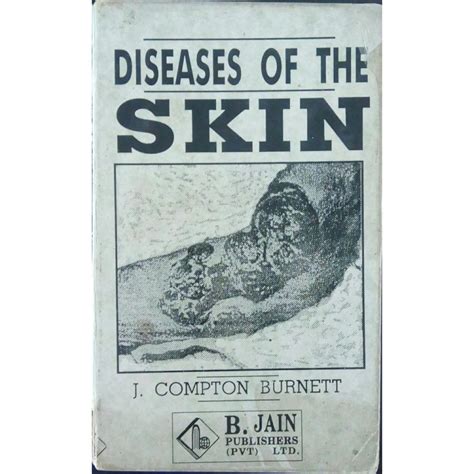 Diseases Of The Skin by J. Compton Burnett – Inspire Bookspace