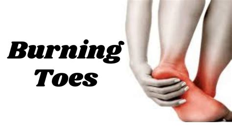 Burning Toes Syndrome- Symptoms, Causes, Diagnosis and More