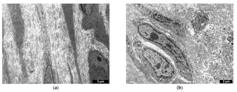 Biocompatibility Study of Hydrogel Biopolymer Scaffold with ...