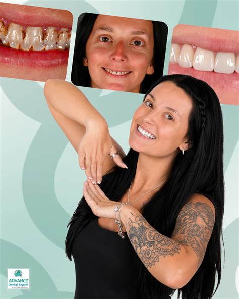 Dental Implants vs Natural Teeth: A Dentist’s Guide