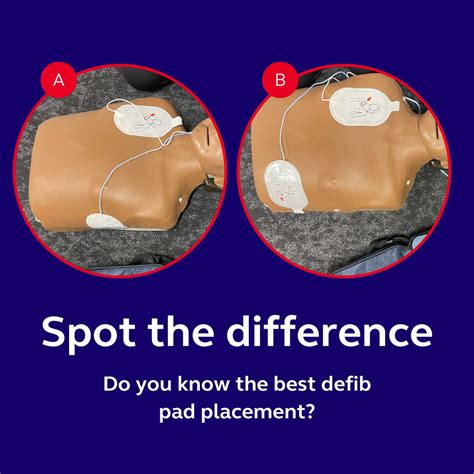 How to place defib pads correctly | Resuscitation Council UK posted on ...