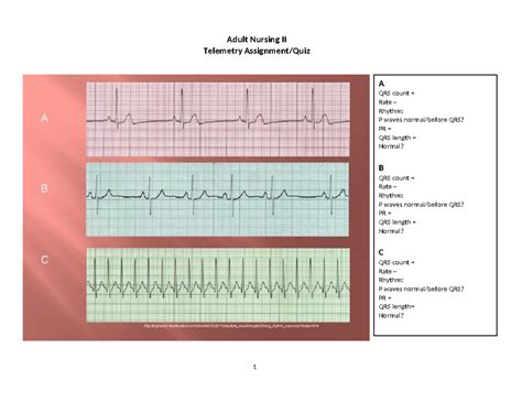Image result for Telemetry Practice