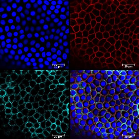 TTCRC - TATA TRANSLATIONAL CANCER RESEARCH CENTRE
