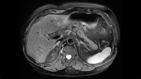 Philips Ingenia Elition 3.0T S