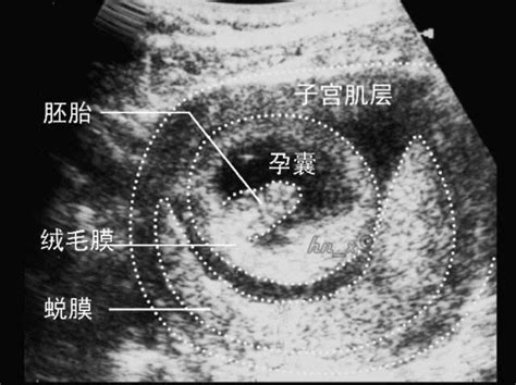胚胎形成“时间轴”：怀孕几周可以看到孕囊、胎心胎芽？孕妈收藏_腾讯新闻