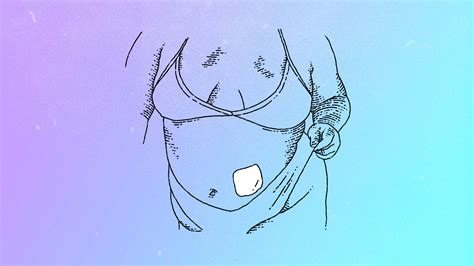 Estrogen Patches for Hormone Replacement Therapy