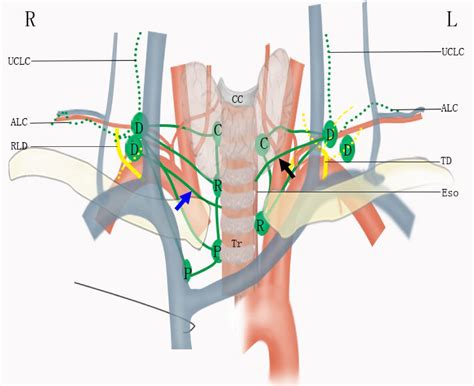 Frontiers | Supraclavicular lymph node metastasis in esophageal ...