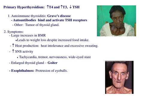 Image result for Thyroid Testing Algorithm