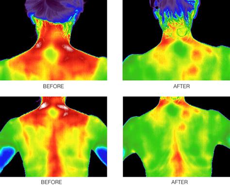 Image result for Microcurrent Technology