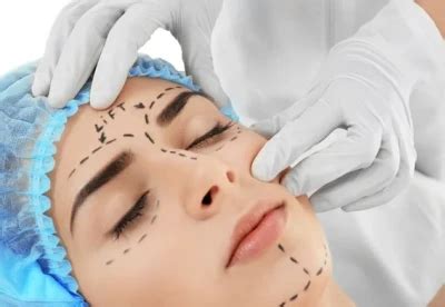 Bliss Derma Clinic Dwarka & Paschim Vihar – Best Skin & Laser ...