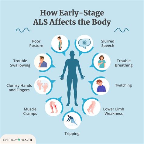 First Sign of ALS in Women: Subtle Warnings
