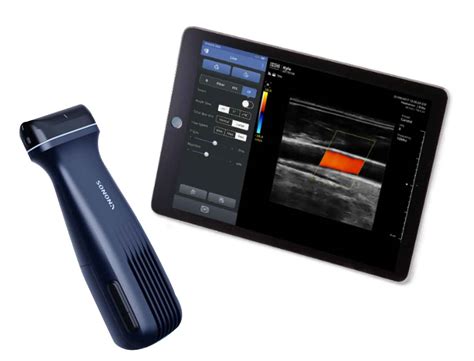 Sonon 500L | Wireless Handheld Ultrasound - Spec Brite Group