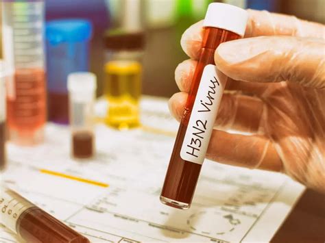 Influenza superfoods: Down with flu? Include these 5 superfoods in your ...