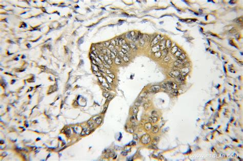 OSBPL9 antibody (11879-1-AP) | Proteintech