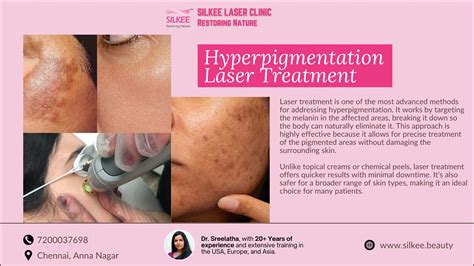 Hyperpigmentation Laser Treatment - Silkee Skin & Hair Clinic