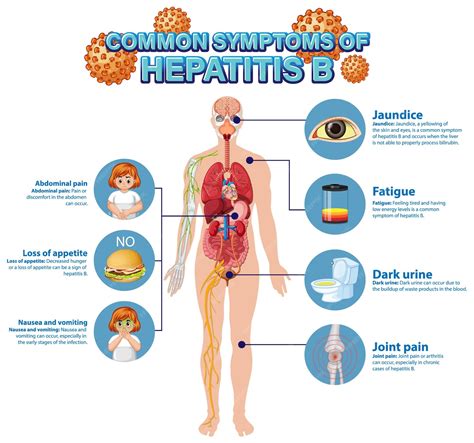Cartel informativo de síntomas comunes hepatitis b | Vector Premium